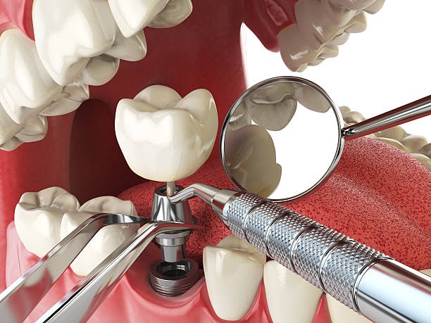 Best Weekend Emergency Dentist in Lexington, IL